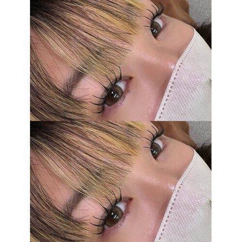 大橋が掲載した施術写真